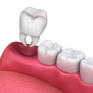 Cirurgias Orais e Extrações de Dentes em Cornélio Procópio 3