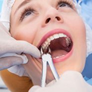 Cirurgias Orais e Extrações de Dentes em Cornélio Procópio 4