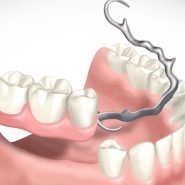 Próteses Dentárias Dentaduras Cornélio Procópio 2