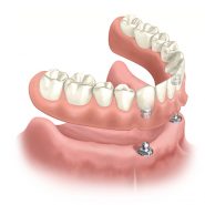 Próteses Dentárias Dentaduras Cornélio Procópio 3