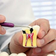 Endodontia em Cornélio Procópio